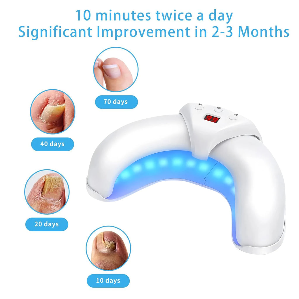 Nail Fungus Laser Treatment Device Fingernail Fungus Treat Onychomycosis Therapy Effectively Remove Onychomycosis Grow Toe Nail