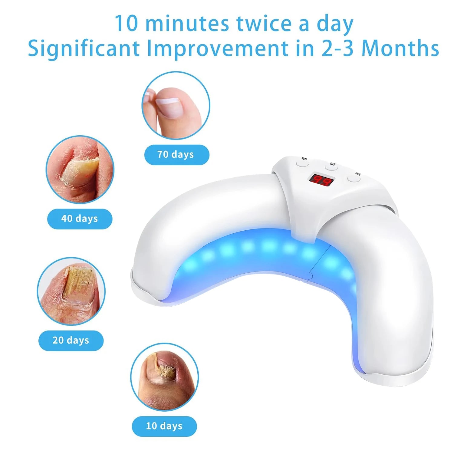 Nail Fungus Laser Treatment Device Fingernail Fungus Treat Onychomycosis Therapy Effectively Remove Onychomycosis Grow Toe Nail